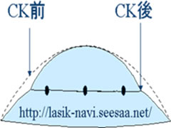 CKの原理.jpg
